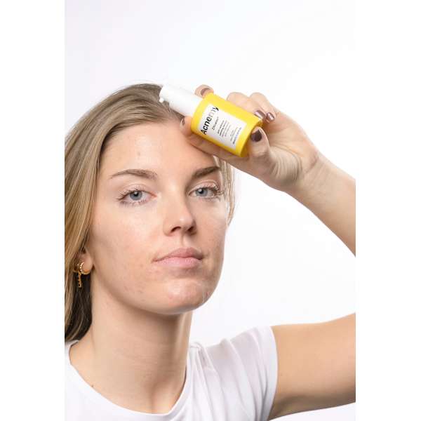 Serum Zitcalm Acnemy