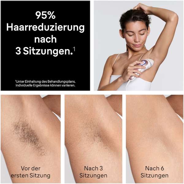 IPL-Gerät, Skin i-expert Pro IPL PL7321 Braun