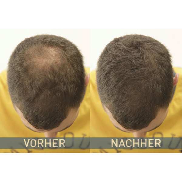 Streuhaar Haarverdichter Dunkelbraun Cover Hair