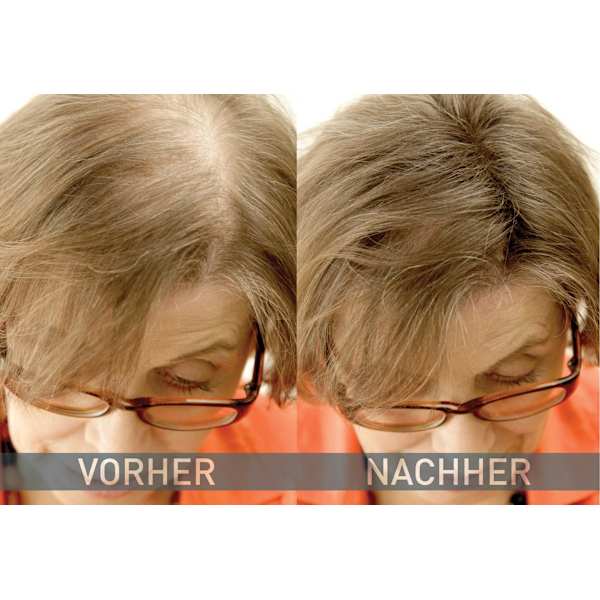 Streuhaar Haarverdichter Mittelbraun Cover Hair