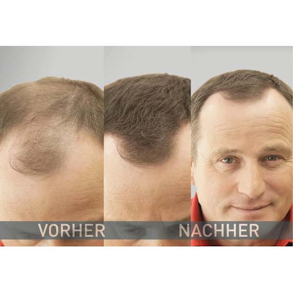 Streuhaar Haarverdichter Mittelbraun Cover Hair