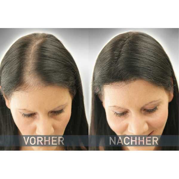 Streuhaar Haarverdichter Schwarz Cover Hair