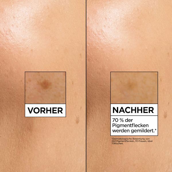 Serum Glow Booster, Vitamin C Anti-Dunkle-Flecken Garnier Skin Active