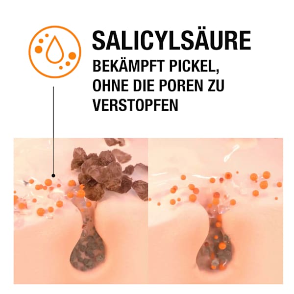 Anti Pickel Feuchtigkeitscreme Neutrogena