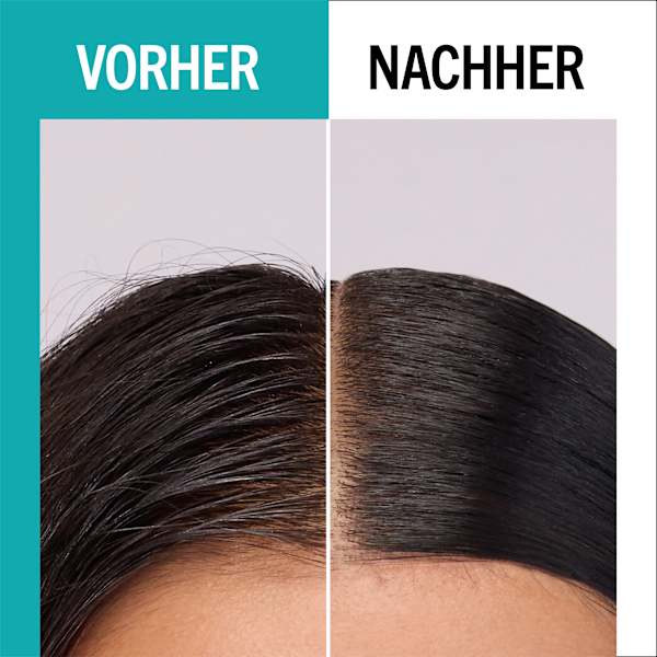 Haarserum scalp balance, klärend Schwarzkopf GLISS
